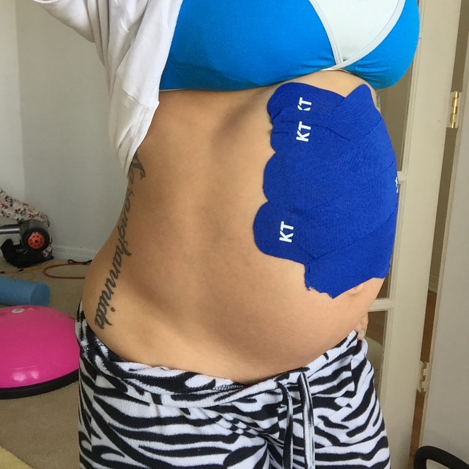 Mommy Tummy” – Evidence-Based Techniques for Treatment and Prevention of  Diastasis Recti